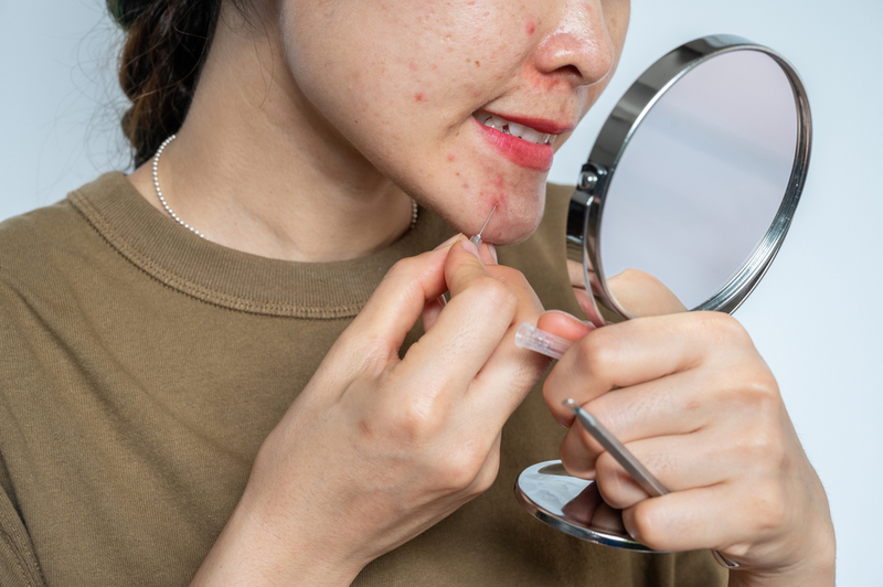 Pimple Popping With Needles | Boyloso/Shutterstock